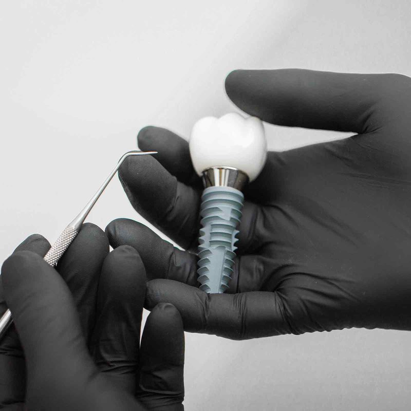 header-dental-implant-denta-samsun-dental-care-antalya-800x800