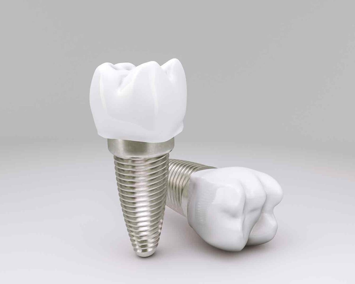 implant4-samsun